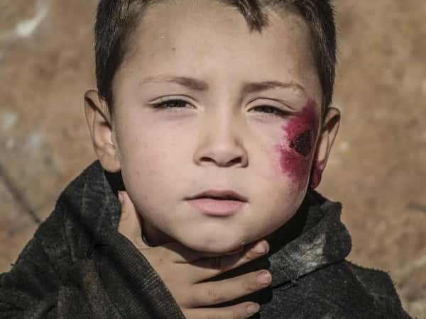 تخديم المخيمات