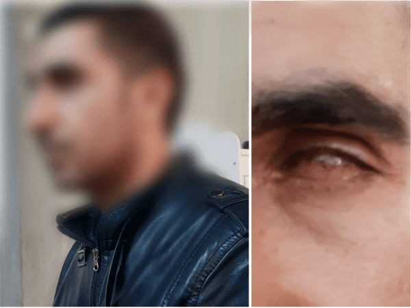 شاب يعاني من إصابة في العين