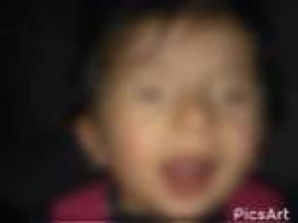 A child needing a lacrimal duct operation