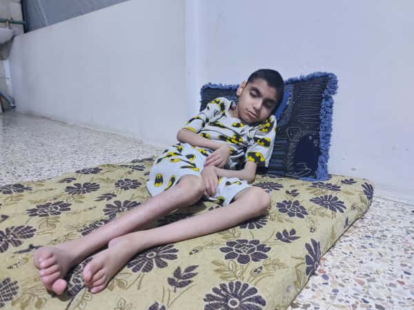 Mohammad is a child facing disability amid life's challenges.
