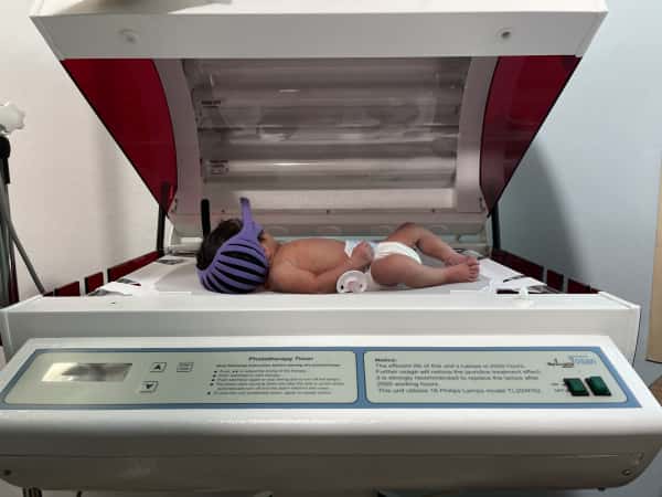 Gaza was born with severe jaundice that is threatening her liver.