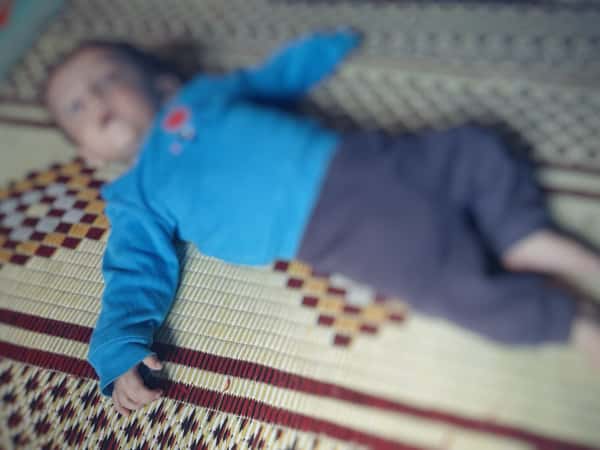 A child suffers from hydrocephalus