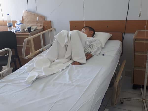 A child with 3 fractures