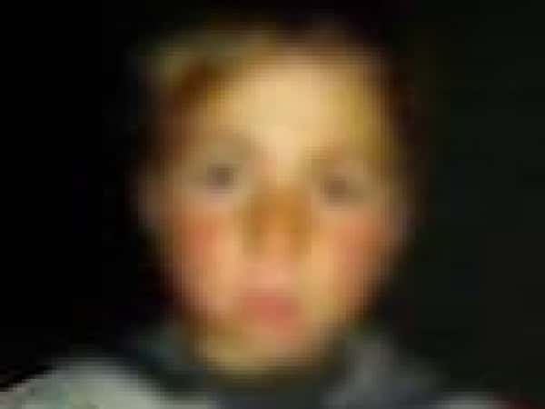 Child need treatment costs