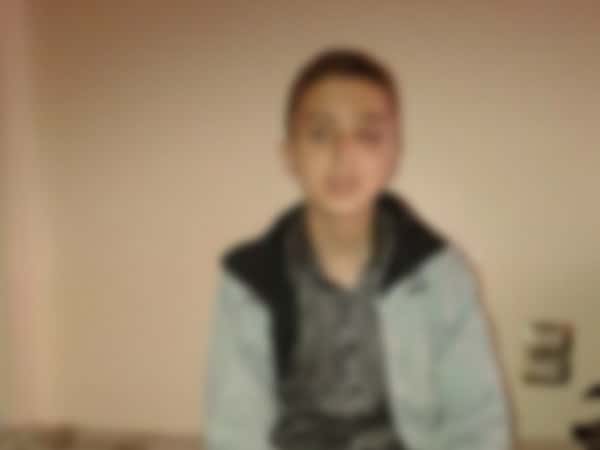 A young man in need for an alternative eye transplantation