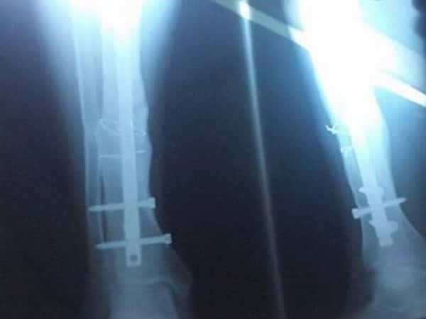 Young man suffering from surgery complications