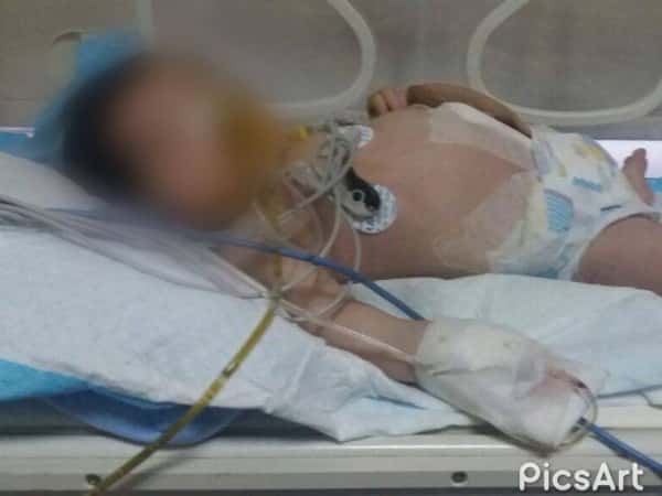 A child in need of a surgical operation