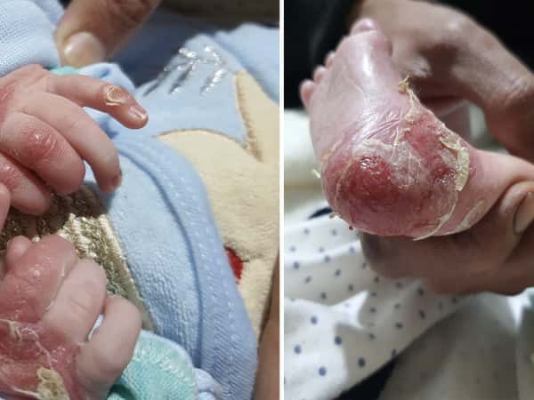 الكفالات الانسانية