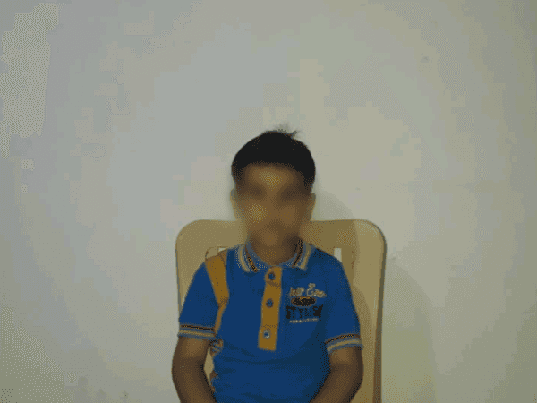 طفل عانى من كسر في محيط عينه