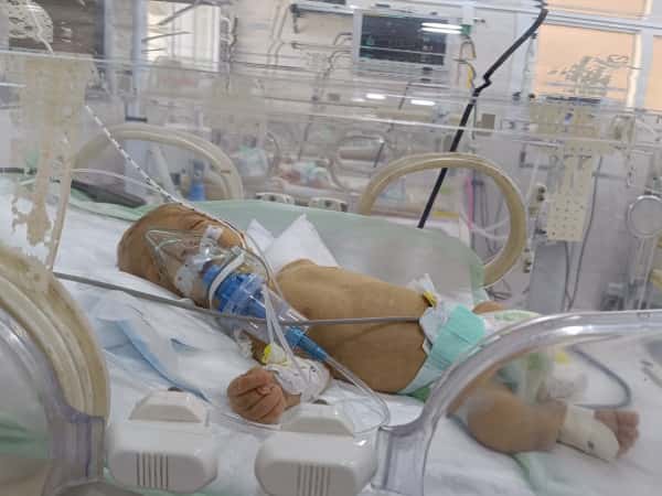 Ali is an infant who has no control over the pain he's feeling, so be the way to relieve his pain and treat it