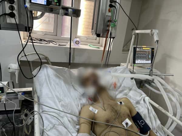 غربةٌ انتهت بحادث.. وحياةٌ يهددها العوز!