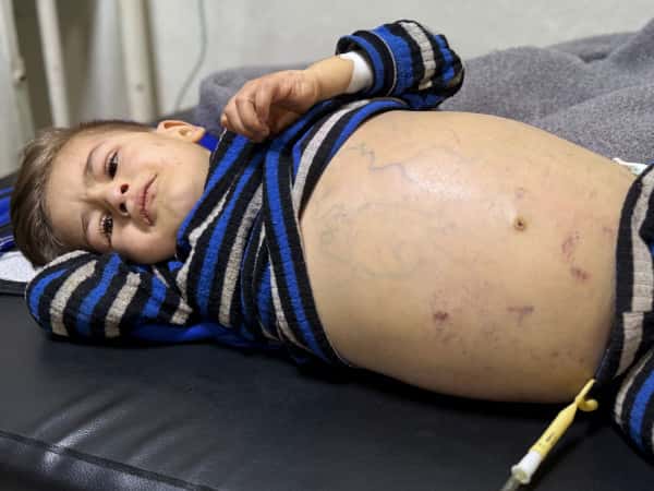 A Fragile Beginning: Ismail’s Fight to Survive