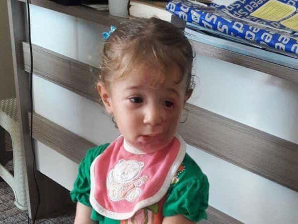 Child needing treatment expenses