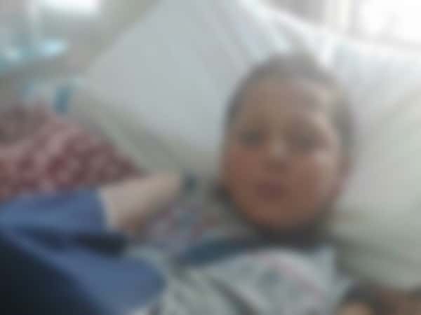 A child with a broken bone