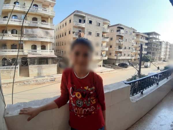 طفلة تعاني من نقص في نمو العظم