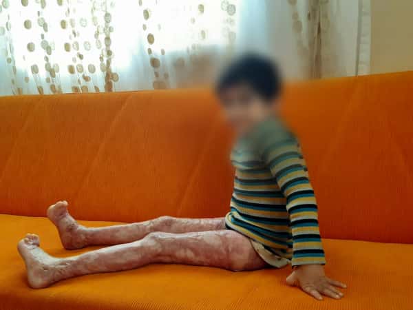 لا تتركوا عمر يعاني أكثر!