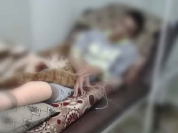mine explosion injury