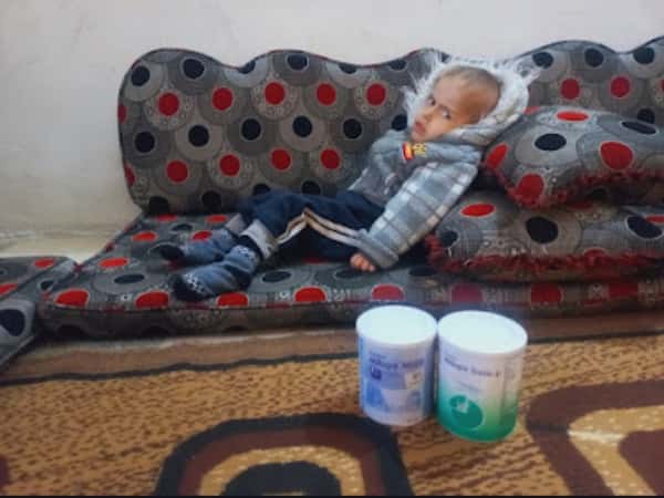 Ahmad suffers from a metobolic disease!