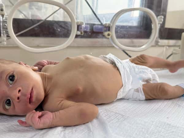 الحالات الإنسانية الطارئة!