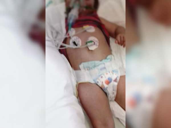 A child fighing the cancer