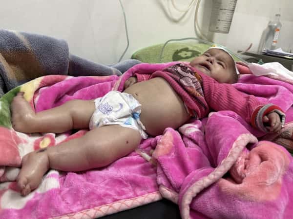 Turfa’s suffering began from the moment she was born