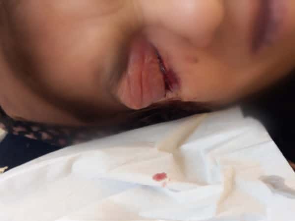 Zamzam needs urgent treatment for her glaucoma