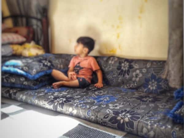 A child suffers from out-toeing