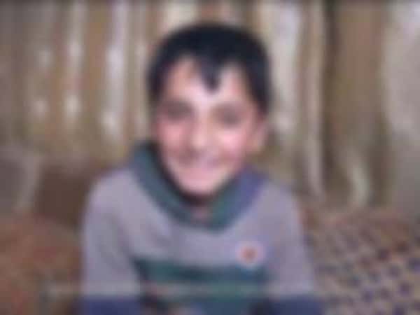 Child needing an hydraulic limb