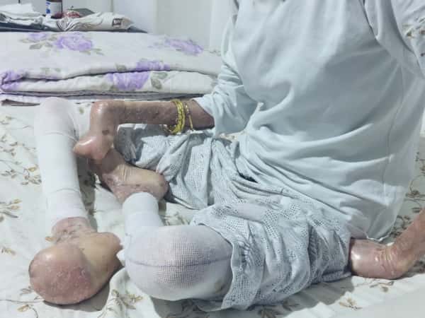 Healing Iman’s Wounds.