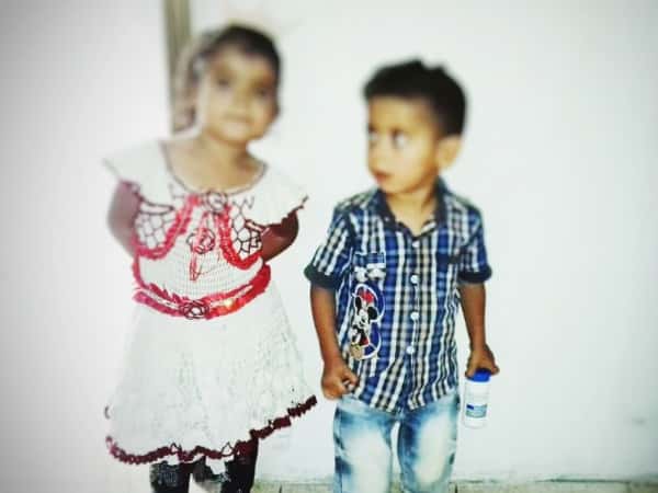 Two siblings suffer from Thalassemia