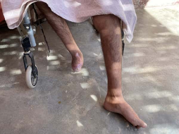 الشاب محمد بحاجة لمساندتكم بأسرع وقت!!