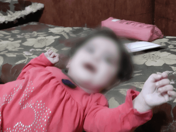 A girl with cerebral palsy