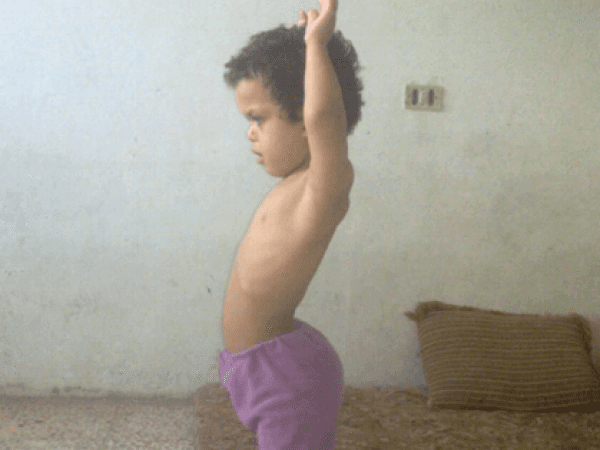 Child needing surgery expenses