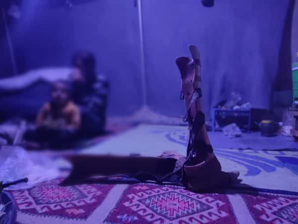 بدون أطراف.. تلك حكاية عبد الستار وعجزه عن تأمين قوت يومه