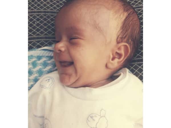 A girl was born with a Spina Bifida
