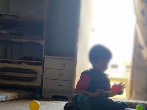 طفل يعاني من حالة مرضية نادرة