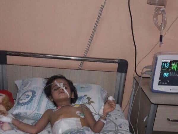 A little girl suffering from Colonic hemiplasia (Hirschsprung Disease)
