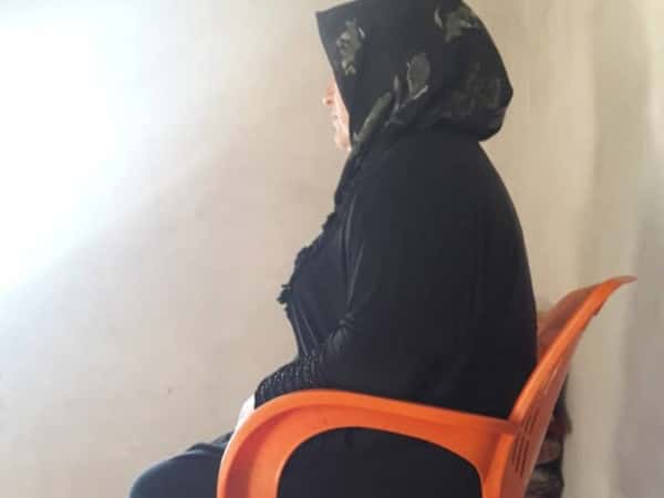 A woman with osteoarthritis ( joint inflammation)