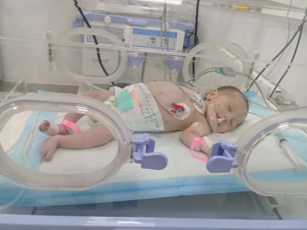 Urgent surgery for an infant