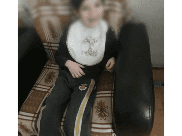 طفل يعاني من ضمور في الدماغ
