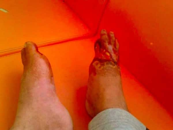 An injured in need for treatment expenses