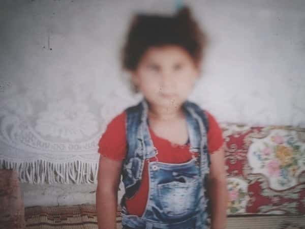 A little girl suffers from Astigmatism!