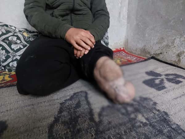 بيتٌ يقف على ساقٍ واحدة