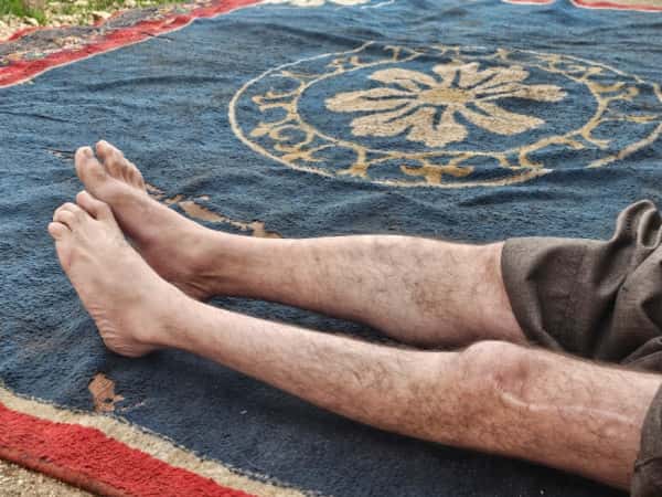 Medical error caused his paralysis