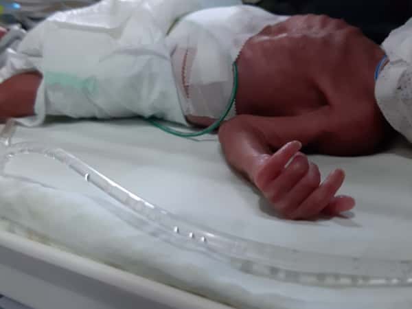 A baby girl needs an incubator