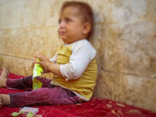 A child with sensorineural hearing loss