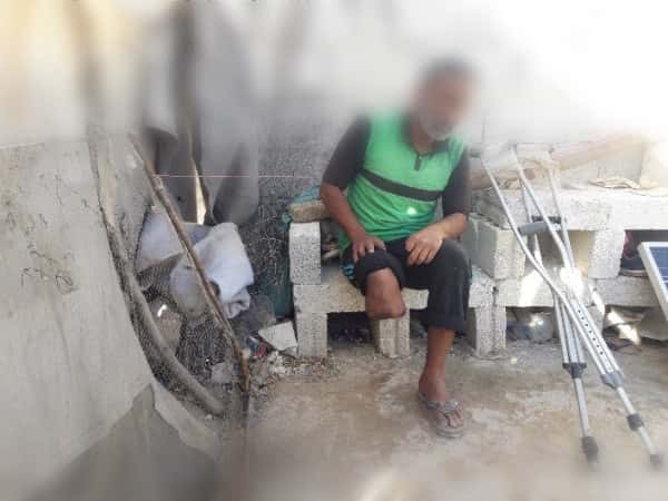 أخذ منه المرض قدمه واليوم هو يأمل بأُخرى صناعية