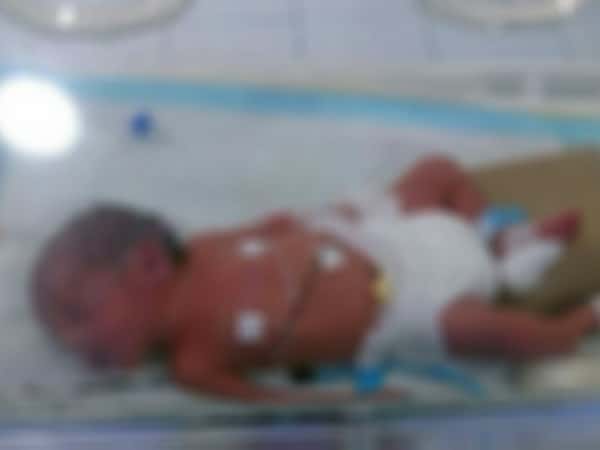An Infant Needs Treatment Costs