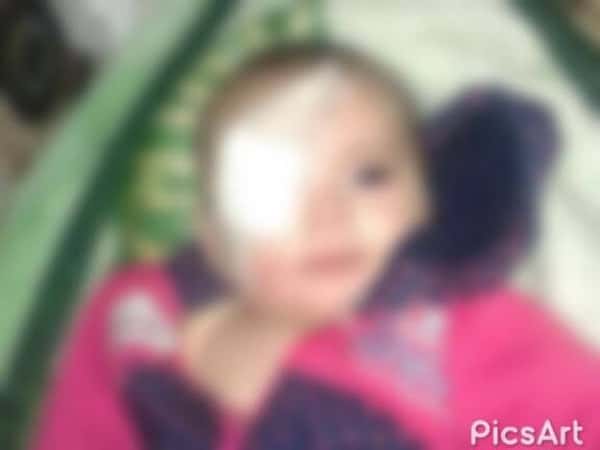 A baby needs eye surgery