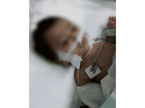 طفل يعاني من تبعات ارتفاع شديد في الحرارة
